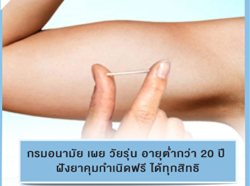 Teenagers under 20 can be implanted with
birth control pills and IUDs. every
right to health free of charge to
prevent pregnancy and continually reduce
the problem of unprepared pregnancy with
advice to teenagers who need advice