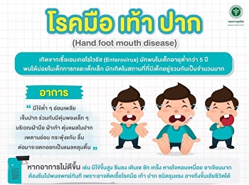 Hand foot mouth disease is caused by
enteroviruses. (Enterovirus)
