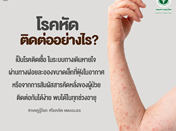 DEALING WITH MEASLES