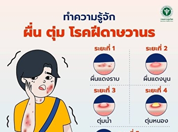 Get to know the rash and bumps of
monkeypox. What do they look like?