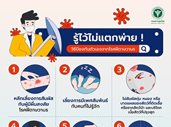 Know this and you won't be defeated! How
to protect yourself from monkeypox? What
should you do?